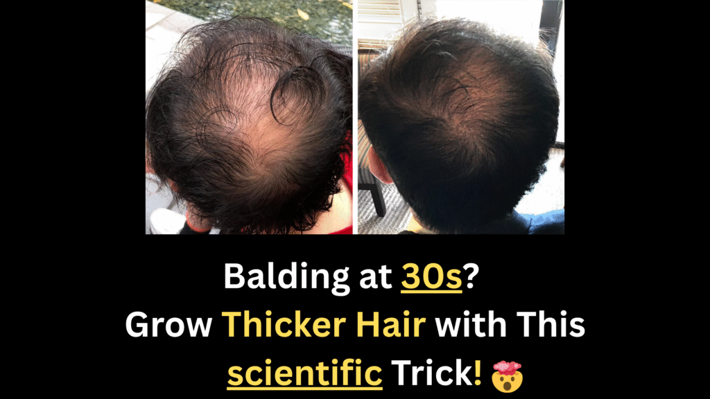 You Won’t Believe These 5 Shocking Hair Regrowth Secrets for Men in Their 30s!